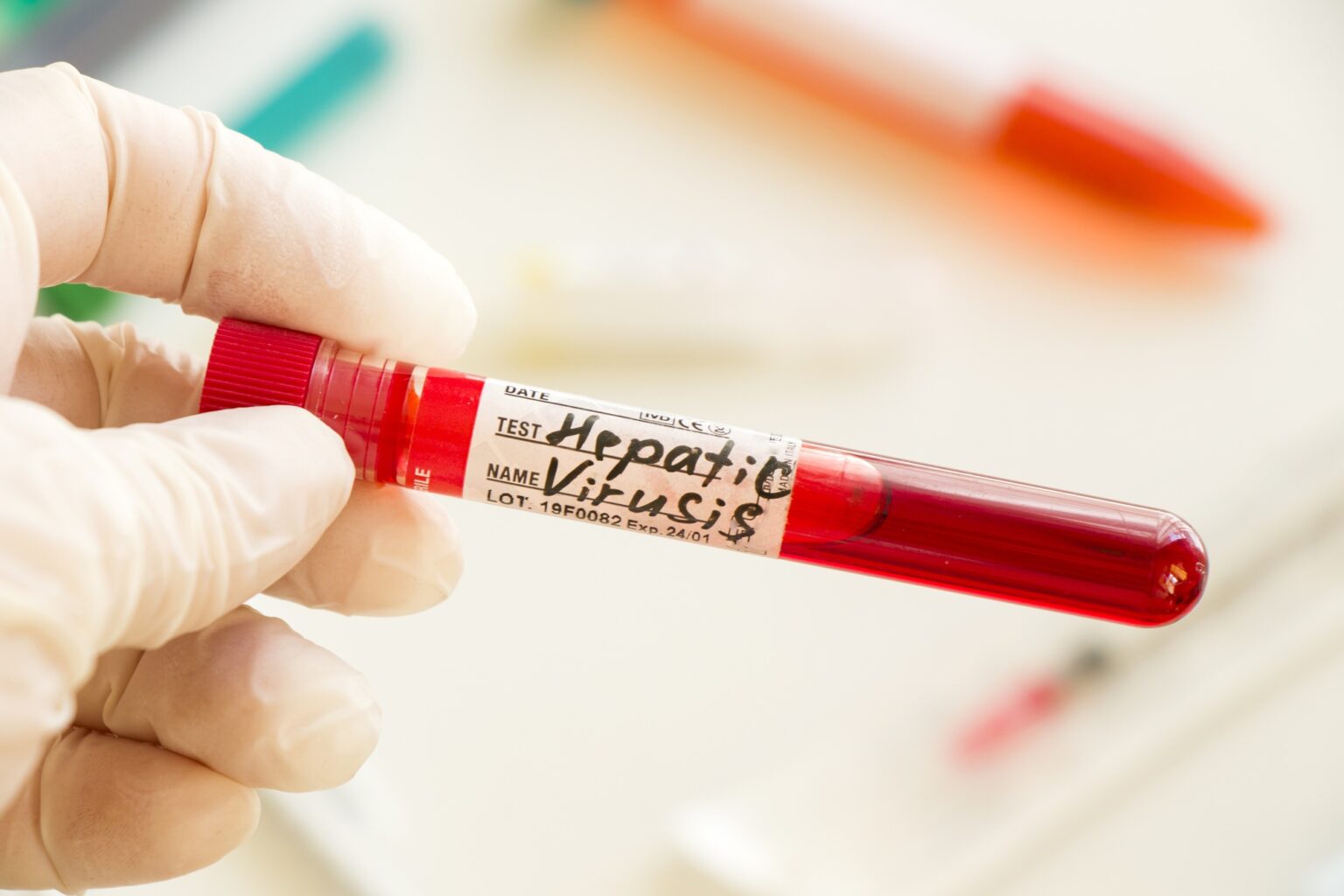 Reconocimiento Nobel 2020 por descubrimiento del virus de hepatitis C y su impacto en México