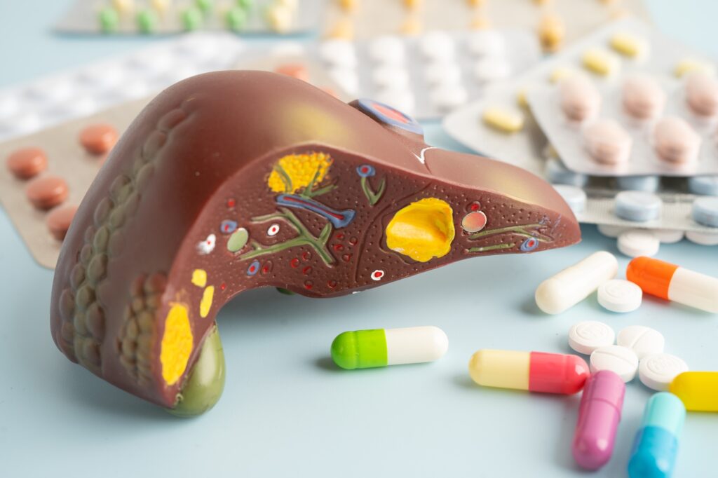 Liver model with pill drug treatment, Cirrhosis, Liver cancer, fatty liver.